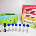 کیت تشخیص ایدز